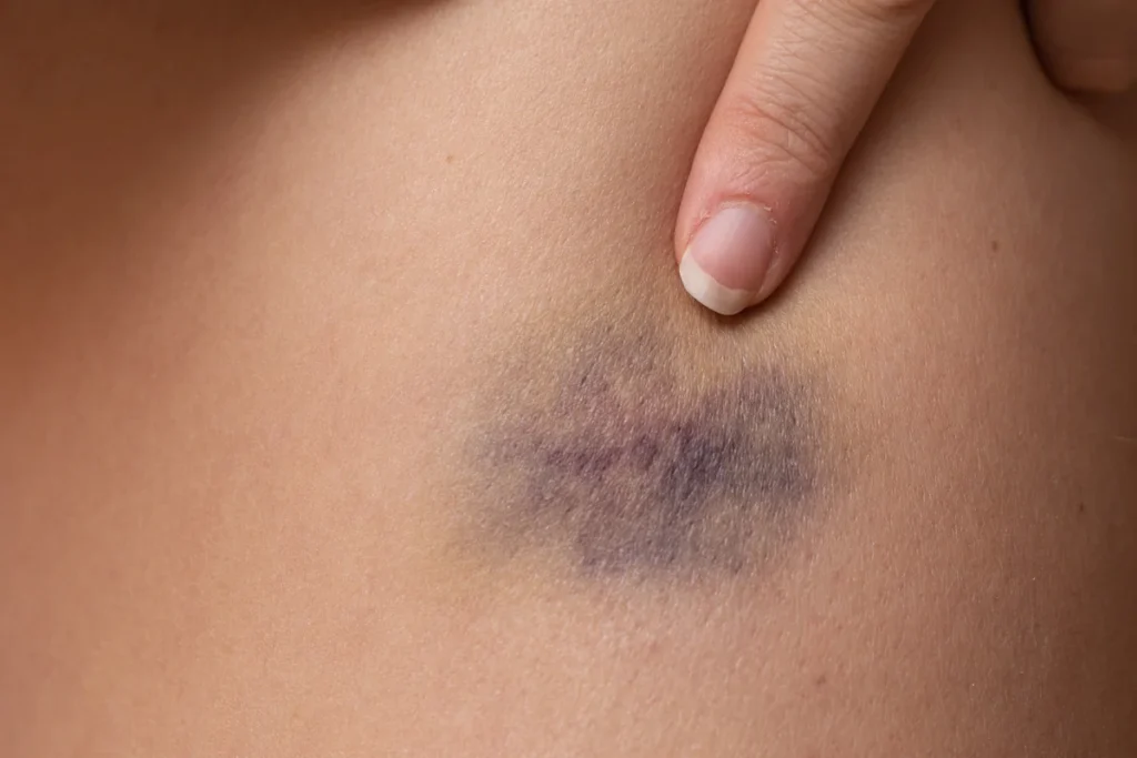 Un doigt qui montre une trace de bleue